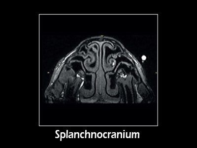 GE 3D T1 aksialna MPR, splanhnokranij
